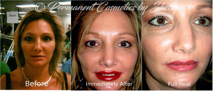 What Is Lip Blushing 2023 My BeforeAfter Pics and Side Effects